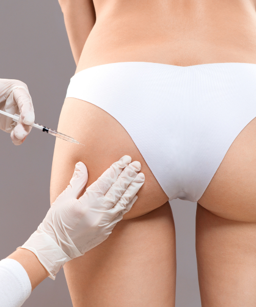 filler.corpo