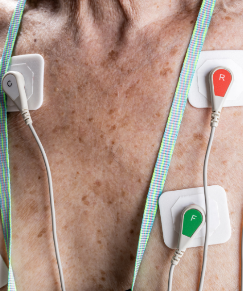 ECG.Holter.24.ore​